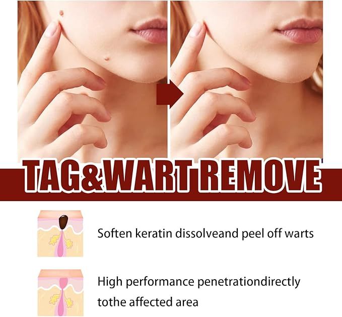 Tags and Moles Remover — product image 2
